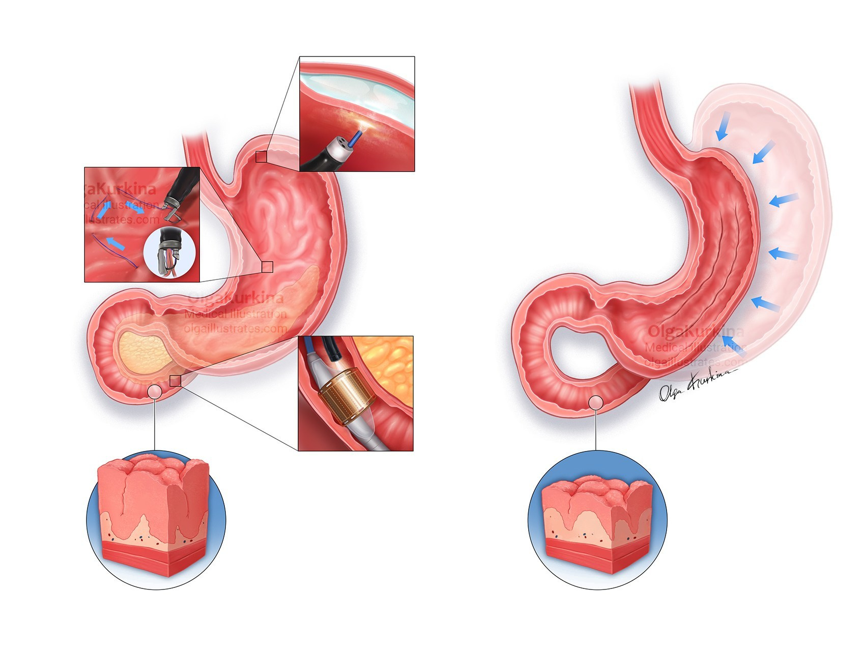 Professional freelance medical illustrator